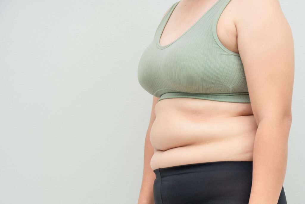 Discover when liposuction is right for you. San Jose residents can explore options at Reveal Plastic Surgery for balanced, enhanced body contours.